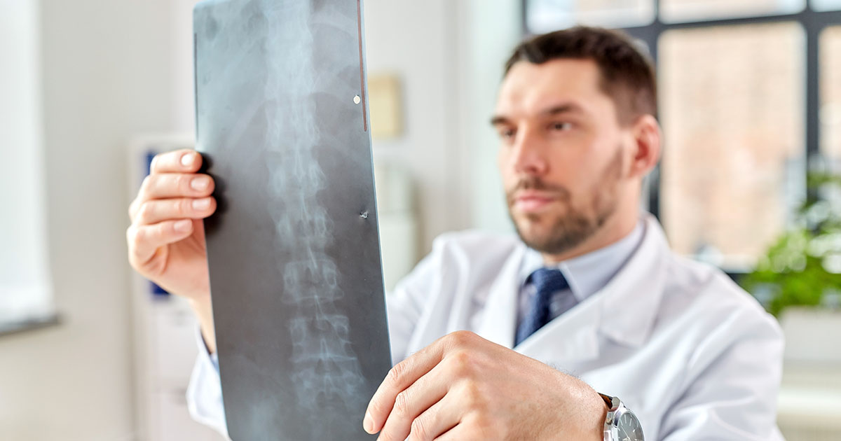 Doctor in white coat examining a spine X-ray in a clinical office, reviewing vertebral alignment