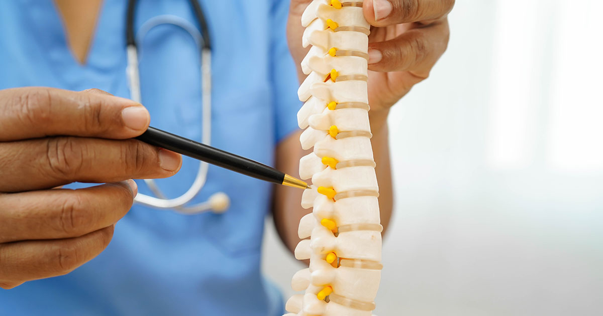 Doctor holding a lumbar spine nerve root model while explaining cauda equina anatomy to a patient