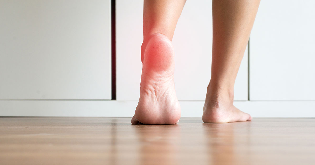 Bare feet on a hardwood floor viewed from behind, with red inflammation highlighted on the heel, illustrating morning plantar fasciitis heel pain