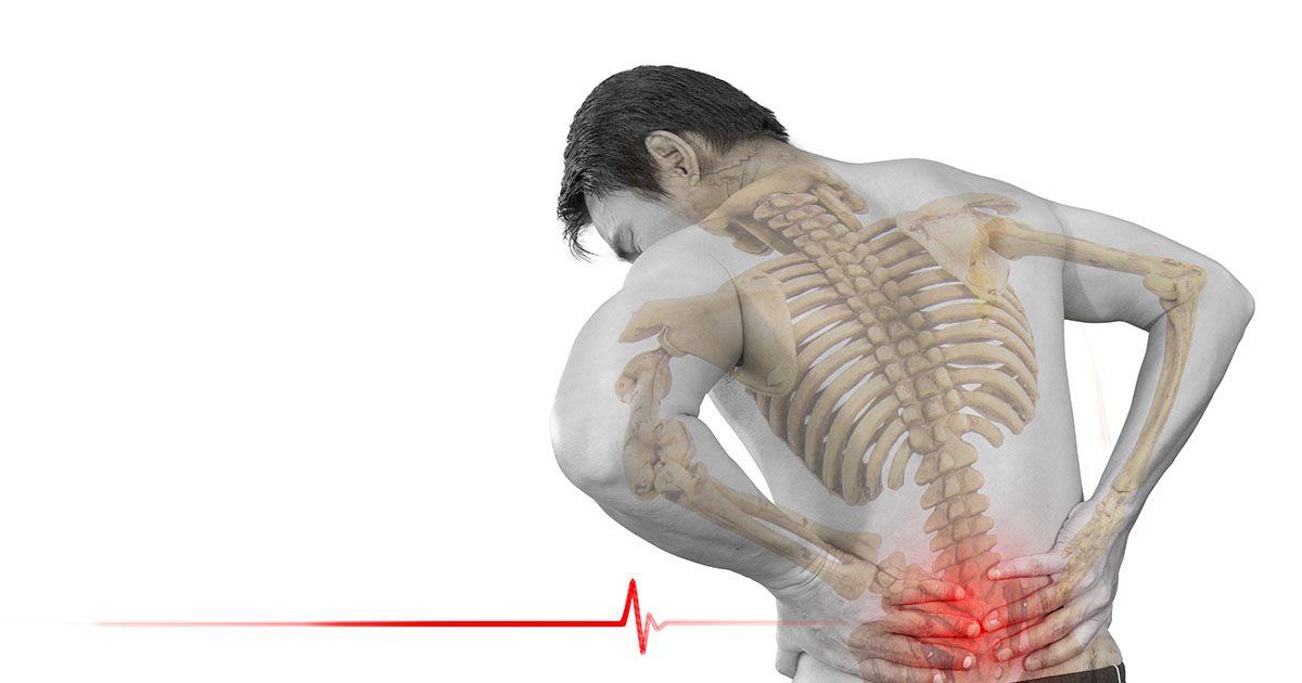 Man with lower back pain shown with skeletal overlay highlighting the lumbar spine, illustrating how old injuries affect spinal structures