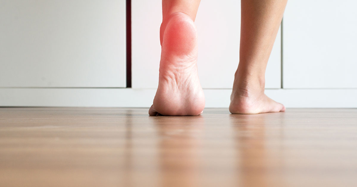 Close-up of bare heels on a hardwood floor with a red inflammation highlight on the left heel, illustrating plantar fasciitis morning heel pain