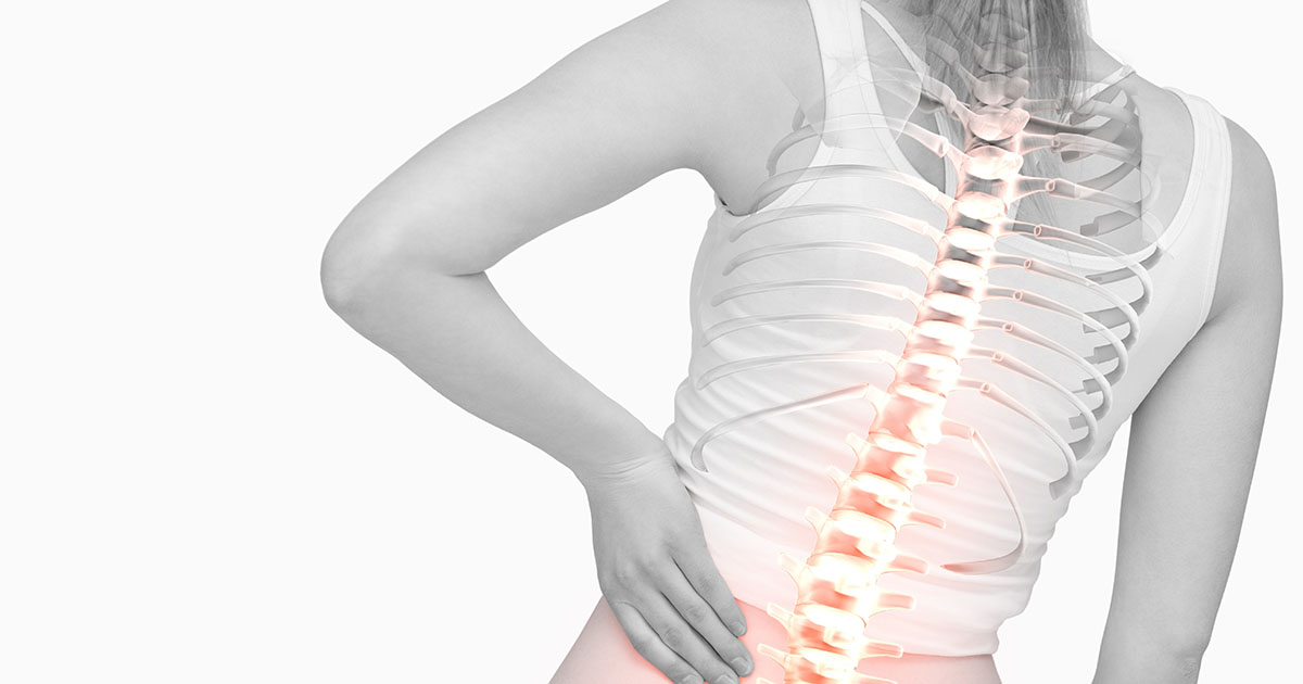 Woman with back turned, showing a digital X-ray overlay of her glowing highlighted spine as she holds her lower back in pain