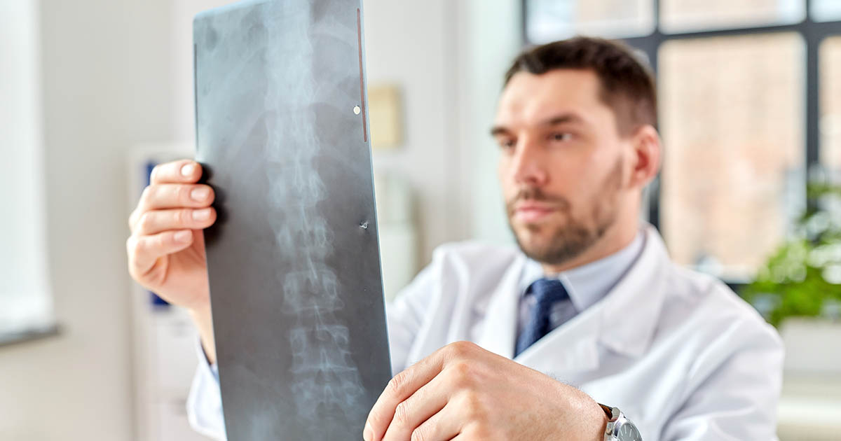 Doctor in a white coat examining a full spinal column X-ray, reviewing vertebrae and disc structures for signs of spondylosis and spinal arthritis