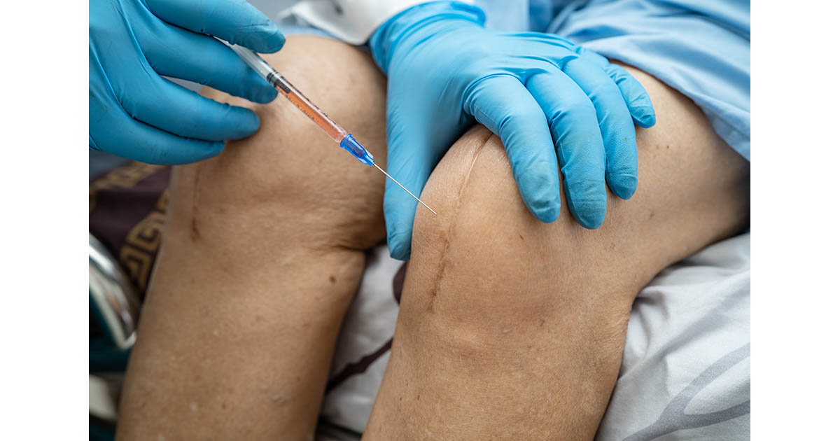 Doctor in blue gloves performing a regenerative injection into a patient's knee, showing the type of biologic procedure offered through the Colombia partnership