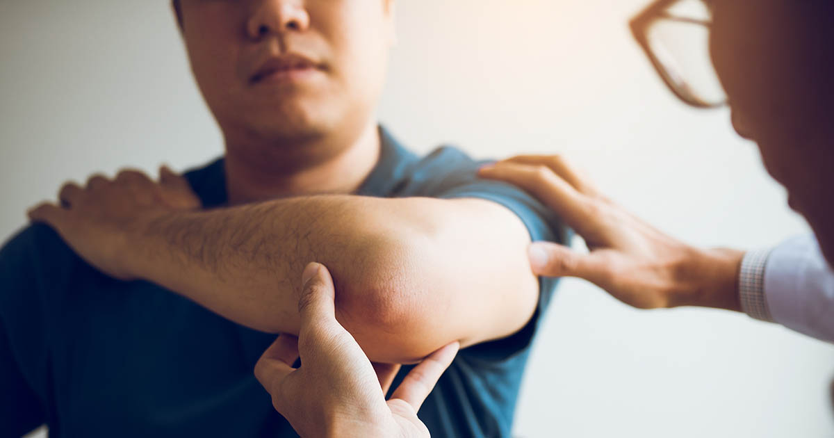 Physical therapist in a clinical setting examining a male patient's elbow, both clinician hands palpating the lateral epicondyle during an evaluation for tennis elbow or golfer's elbow