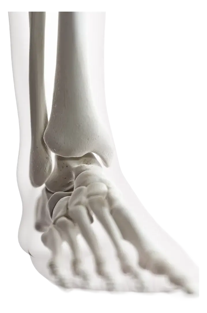 3D anatomical render of the foot and ankle showing the calcaneus and plantar fascia